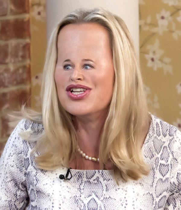 Katie Price